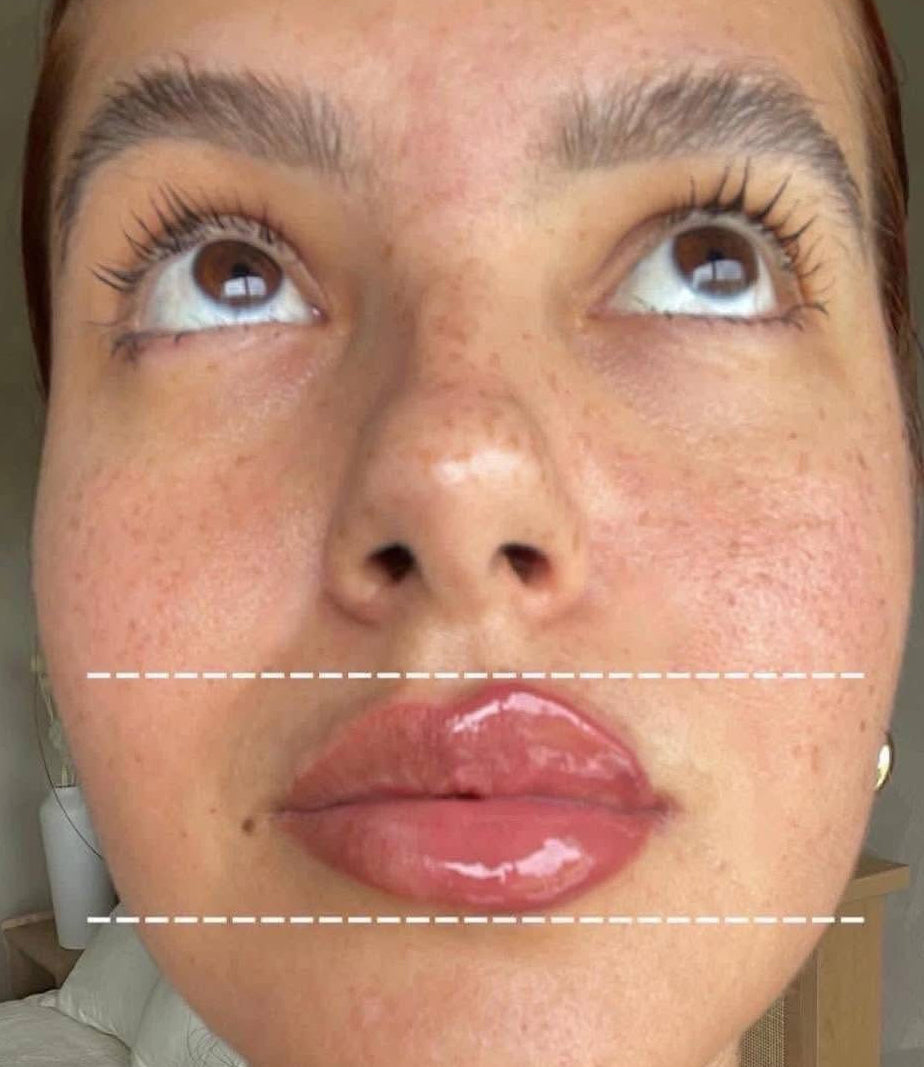 Voluminizador de Labios Extremo 20 ML