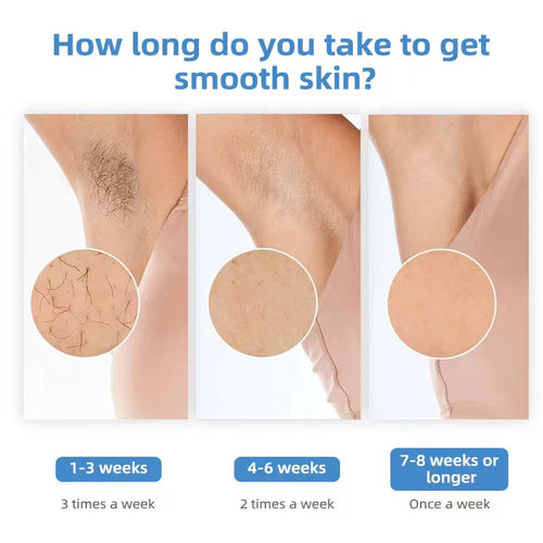Cooling Hair Removal